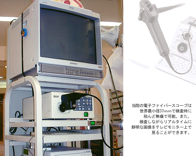 超細径電子ファイバースコープと超小型マイクロプロセッサー画像ファイリングシステム